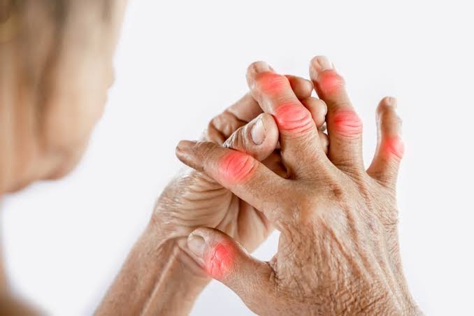 arthritis pain